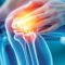 knees, osteoarthritis, body, x-ray, anatomy, pain, medical, health, injury, joints, skeleton, scan, arthritis, bones